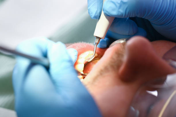 Professional Emergency Dental Service in NY